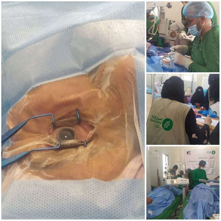 تواصل أعمال المخيم الطبي المجاني للعيون في ردفان والذي تنفذه جمعية العـون المبـاشـر