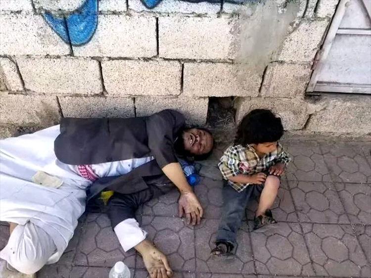 مشهد صادم في اب.. مواطن يفارق الحياة جوعًا على قارعة الطريق وبجواره طفله الصغير