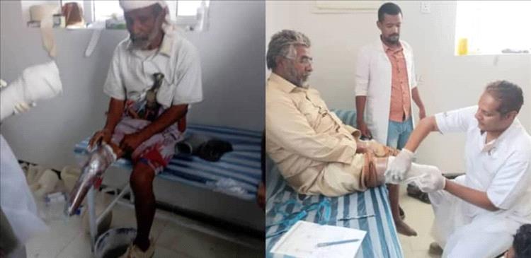 فريق طبي يركب أطرافًا صناعية لـ 20 مريضًا من منتسبي جمعية رعاية وتأهيل المعاقين بشبوة