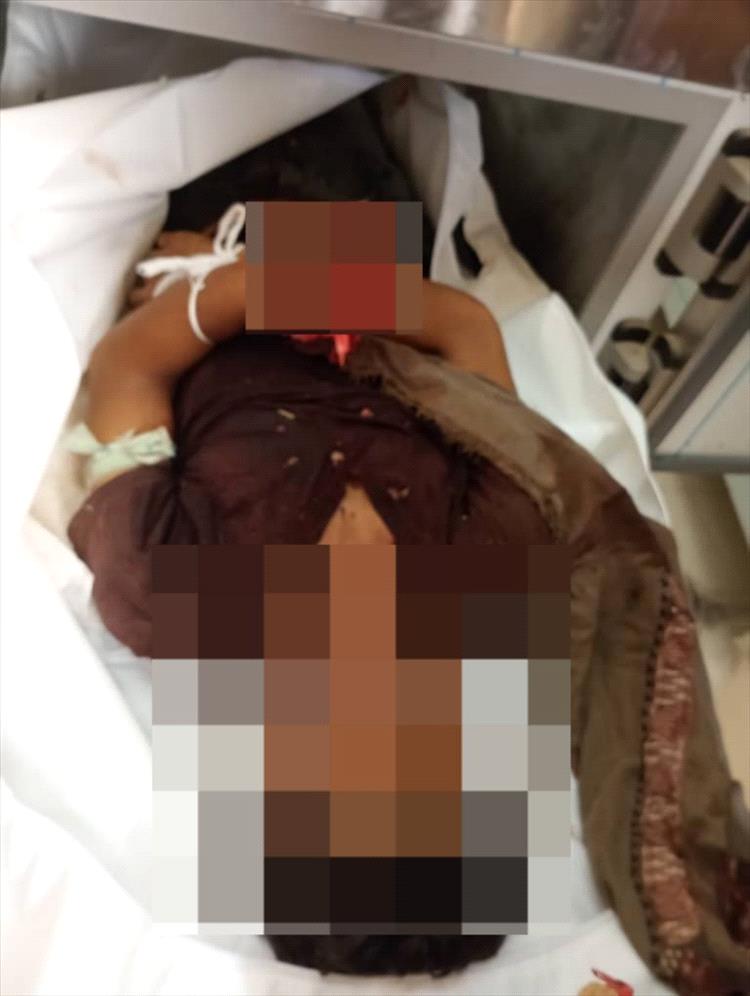 مقتل شاب بانفجار عبوة ناسفة في لودر بأبين