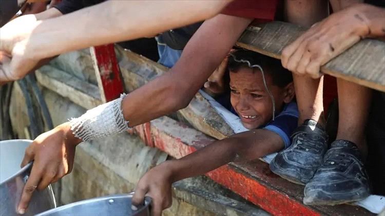 الأمم المتحدة: أكثر من 100 طفل فلسطيني قضوا جوعاً في غزة