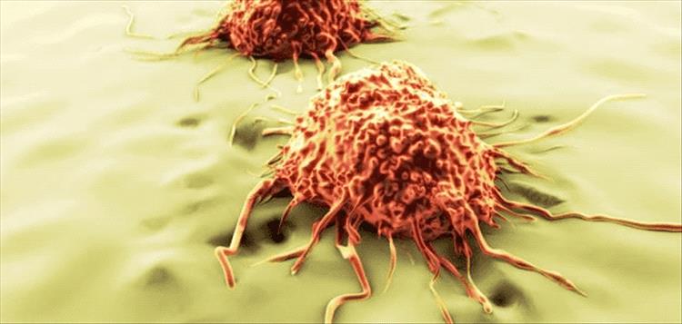 هل السرطان معدٍ؟ دراسة توضح الحقيقة