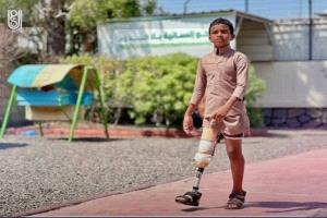 مركز الأطراف الصناعية بعدن يقدّم خدماته لـ595 مستفيداً خلال يوليو المنصرم
