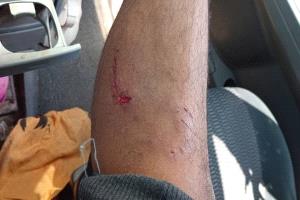 هجوم كلب مسعور يُصيب مواطنين في حي حاشد بالمنصورة