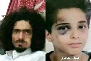 طفل يتعرض لاعتداء وحشي في صنعاء.. تفاصيل القصة الكاملة