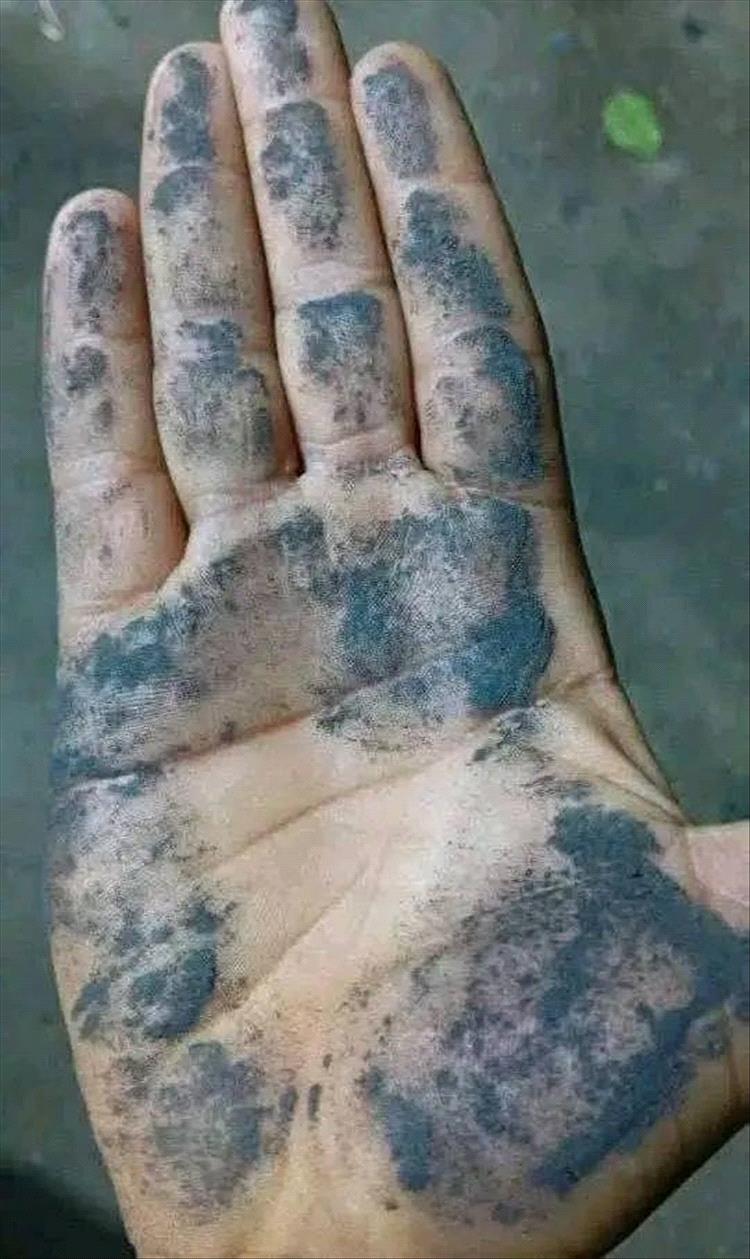 سحابة دخانية غريبة فوق الضالع… مادة سوداء تتساقط من السماء بسبب انفجار بركاني في إثيوبيا