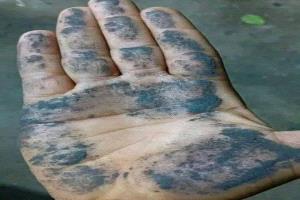 سحابة دخانية غريبة فوق الضالع… مادة سوداء تتساقط من السماء بسبب انفجار بركاني في إثيوبيا