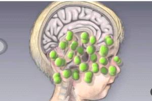 تسجيل 26 حالة وفاة و1,232 إصابة بمرض منتشر في ثلاث محافظات