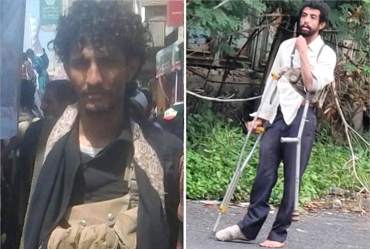 مجلس المقاومة الشعبية بتعز: استشهاد مقاتلَين مُعاقَين في جبهة كلابة "رسالة صمود وعزّة "