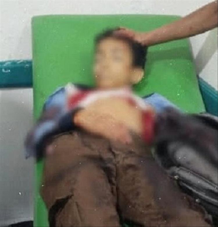 مقتل طفل برصاص قناص حوثي أثناء عودته من المدرسة شمالي تعز