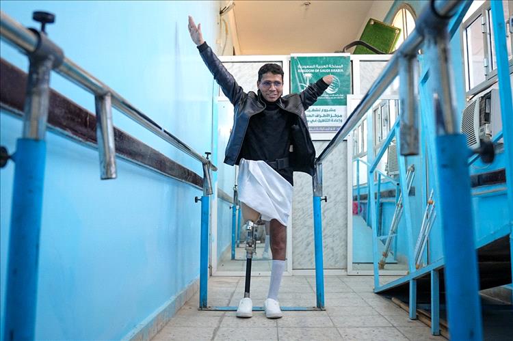 بمرحلته الحادية عشرة .. مركز الأطراف الصناعية بمأرب ٥٧٦ مستفيد خلال مارس المنصرم