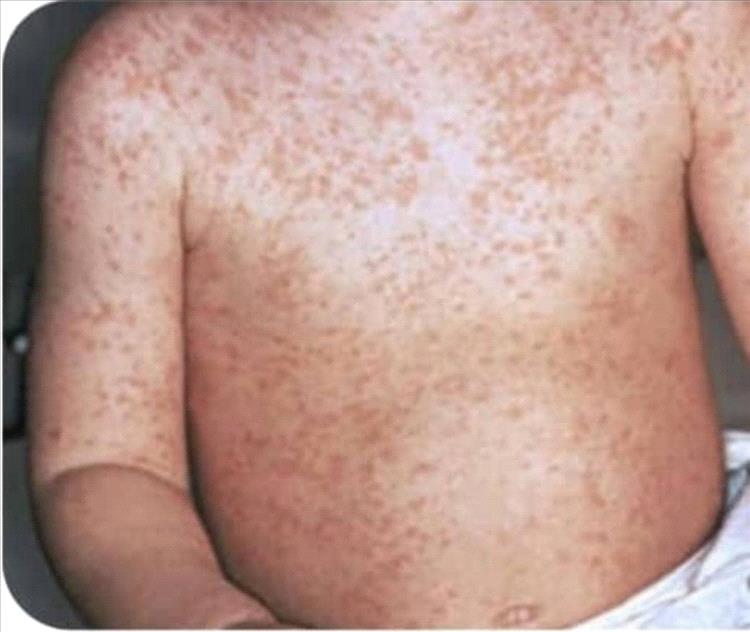 وفاة طفلة بعد رحلة بحث عن سرير عناية مركزة في مستشفيات المكلا