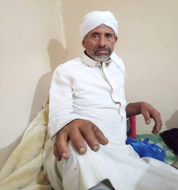 تعز .. عصابة مسلحة تنهب مواطناً وتتركه في غيبوبة بـساحة الحرية