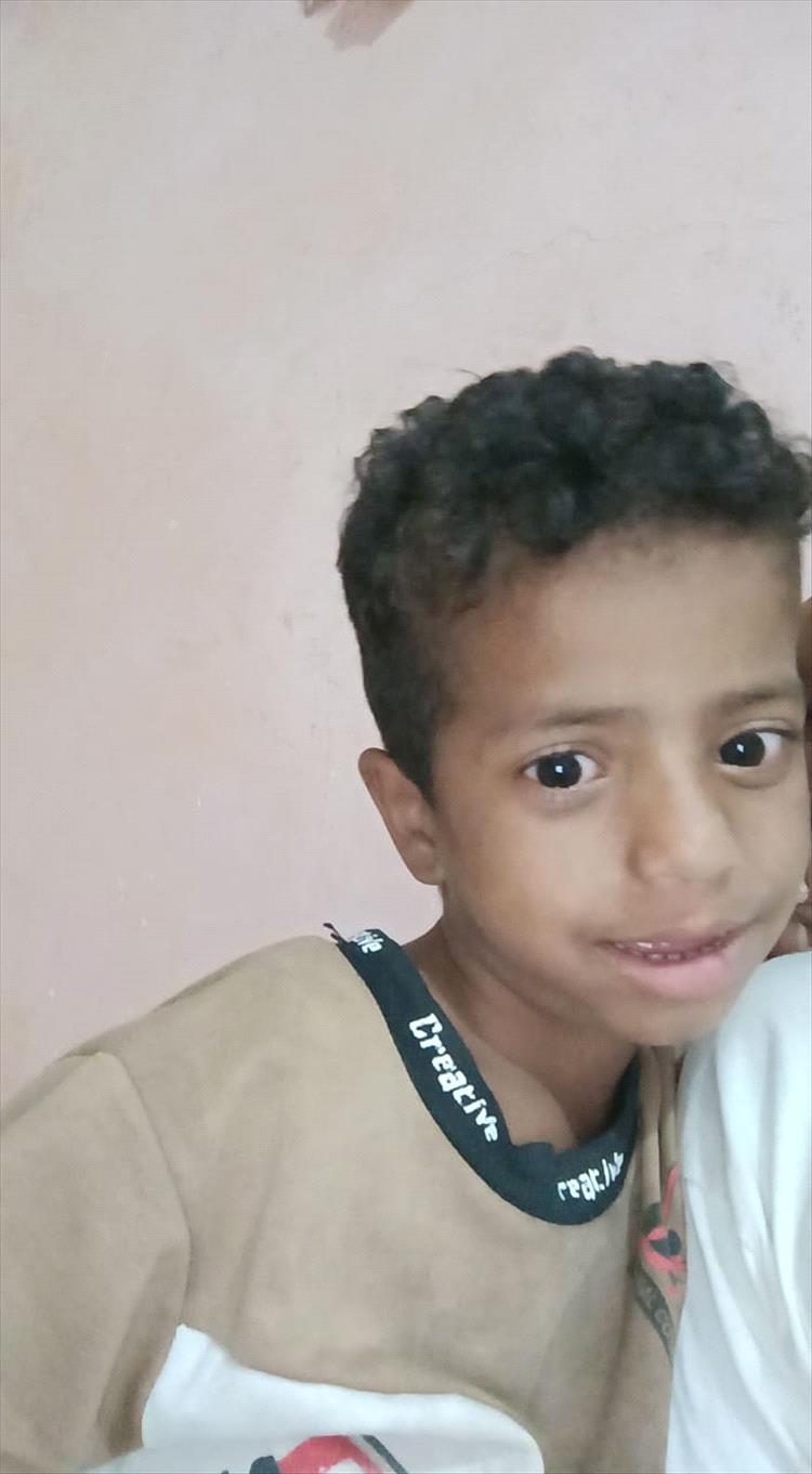 مناشدات عاجلة في الضالع جراء تفشي وباء "فطريات اللسان" بين أطفال منطقة تورصة