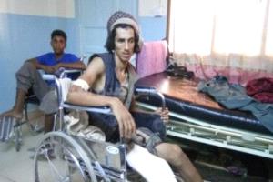 رئيس الرابطة الوطنية للجرحى: معاناة الجرحى في اليمن متفاقمة وتطال مختلف الجوانب