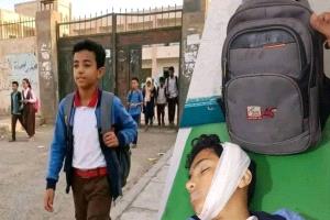 وكيل أول محافظة تعز يعزي باستشهاد الطفل إبراهيم جلال