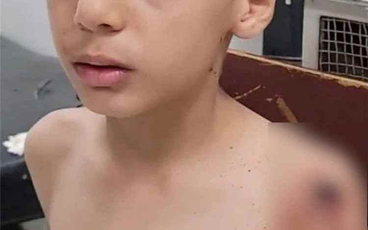 إصابة طفل بشظية جراء قصف حوثي استهدف حياً سكنياً في تعز