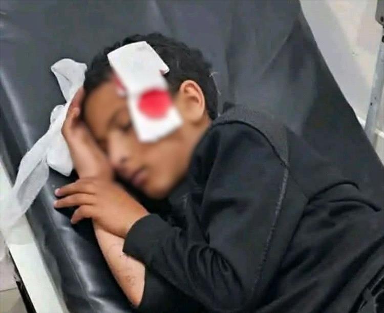 إصابة طفل برصاص قناص حو_ثي في تعز
