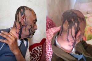 اعتداء وحشي على مُسن في عمران