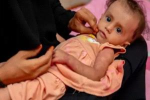 الصحة العالمية: اليمن يقترب من انهيار صحي شامل وسط أزمات متفاقمة