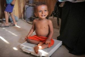 يونيسف تدعم علاج 166 ألف طفل يعانون من سوء التغذية الحاد الوخيم في مناطق خاضعة لسيطرة الحوثيين