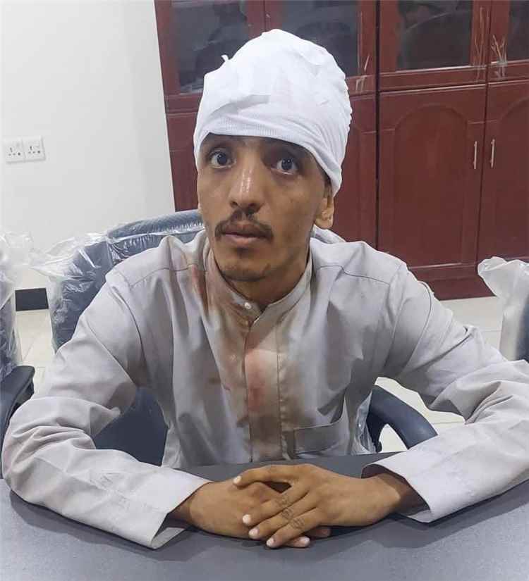 أصيل السقلدي: التحقيقات تكشف هوية المعتدى عليه في أحداث ساحة العروض وتنفي عمله مع أي قناة فضائية