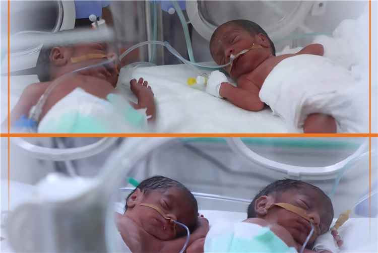 ولادة نادرة لأربعة توائم في مأرب والأم والمواليد بصحة جيدة