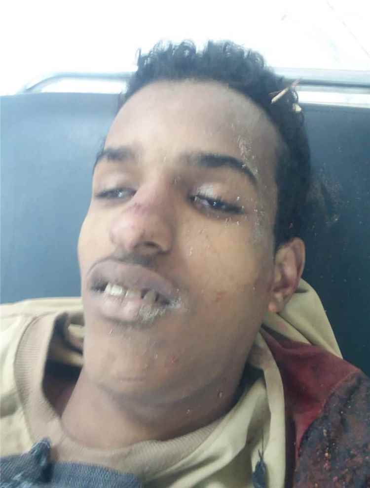 مقتل شاب برصاص مسلح في سوق المحلة بمحافظة لحج