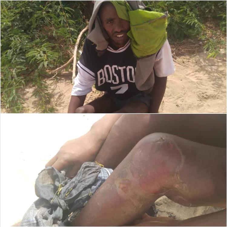 تنامي شكاوى حول انتهاكات وعمليات ابتزاز يتعرض لها مهاجرون أفارقة في مديرية أحور