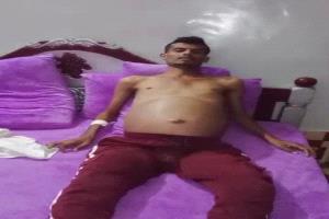 مناشدة إنسانية عاجلة .. مريض من أبين يحتاج دعمًا لإجراء عملية زراعة كبد خارج البلاد