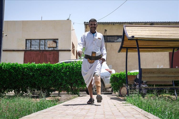 مركز الأطراف الصناعية بمأرب يقدم خدمات مميزة خلال شهر ابريل المنصرم