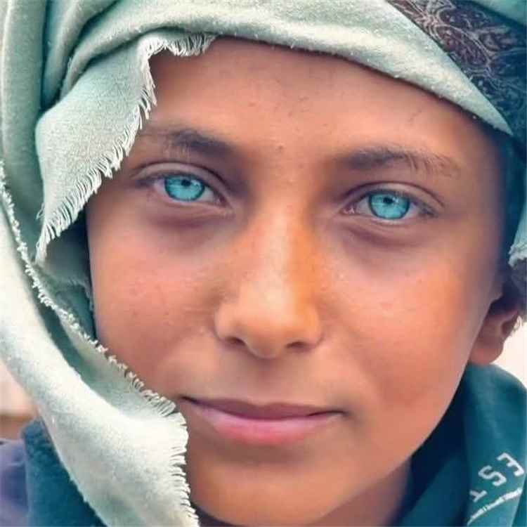 رسام الأنسي يخطف أضواء الحرب بعينيه ويتحول لظاهرة على السوشيال ميديا