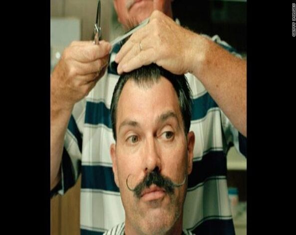 رواج جراحة تجميل الشوارب بالشرق الأوسط