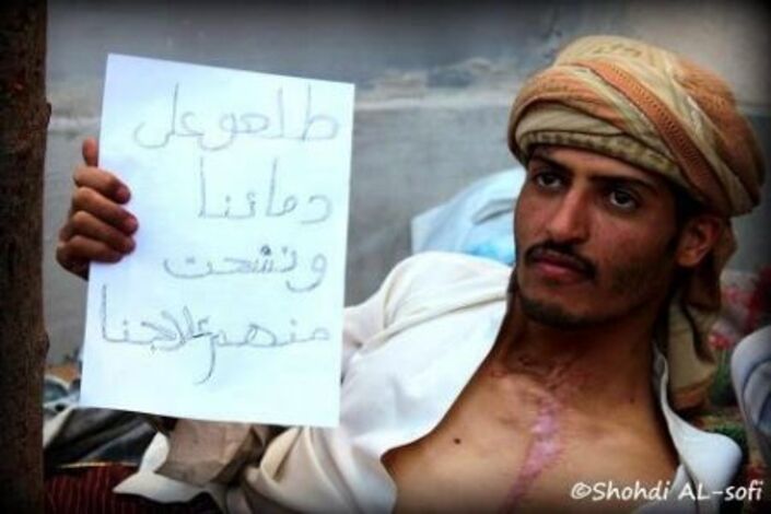 ثورة التغيير تدخل مرحلة الاغماء