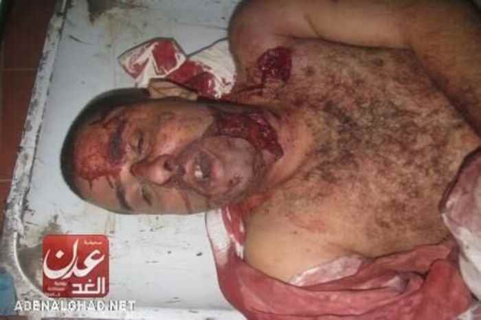 تفاصيل : مقتل نجل المستثمر الشرفي من قبل مسلحين بلحج (مصور)