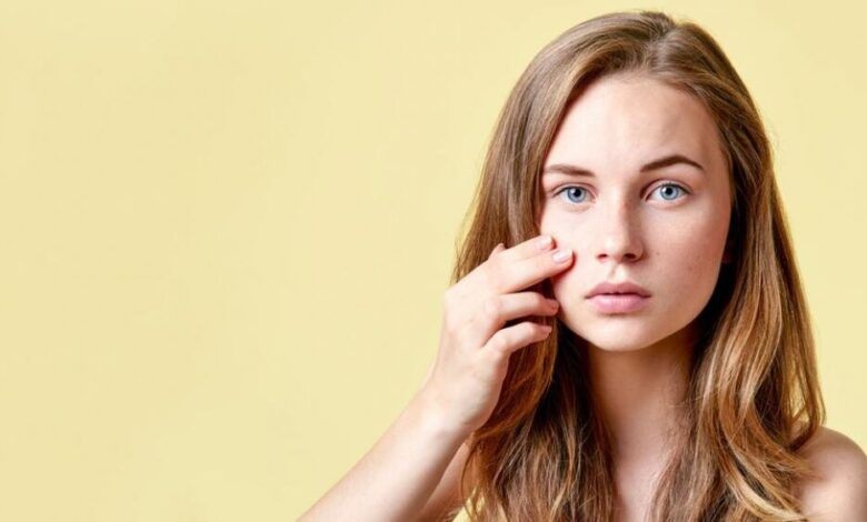 الزوان وحبّ الشباب رفيقان يعكران صفو البشرة فما العمل؟