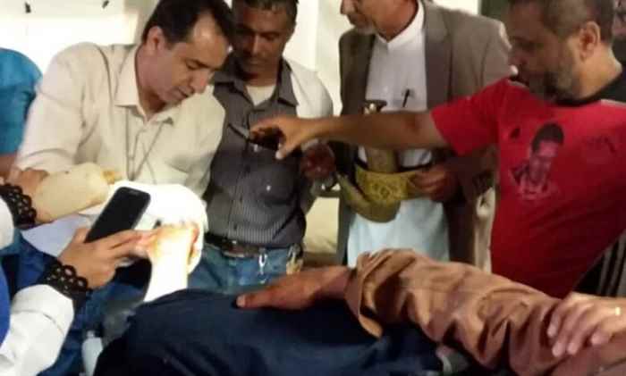 مسلح يصيب موظفان بمشروع مياه ذبحان بالتربة بتعز