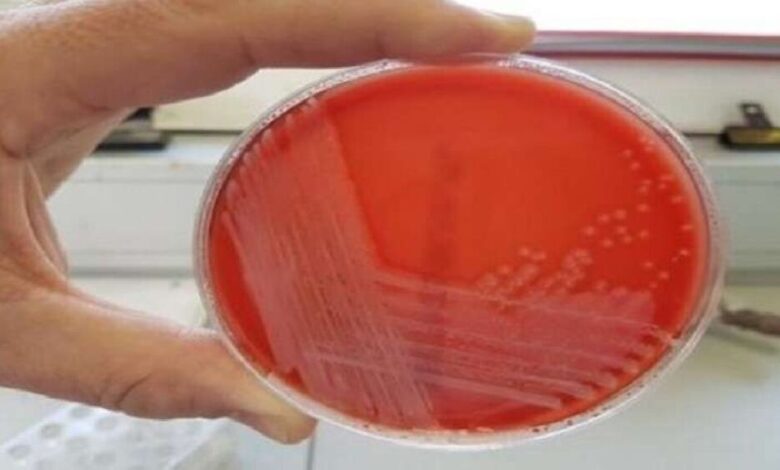 علماء يطورون جهازا لاكتشاف البكتيريا في دقائق