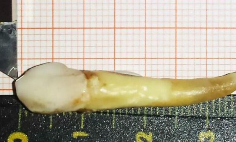 كرواتي يدخل موسوعة «غينيس» بأطول سن بشرية