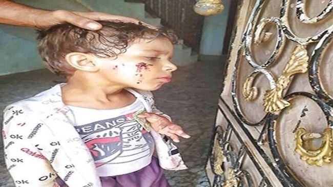 في ظل إصابة الأطفال.. انتشار الكلاب الضالة المسعورة يثير مخاوف أهالي لودر أبين